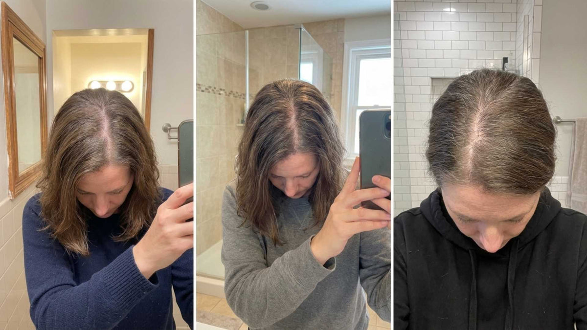 Close-up of a woman's part line showing visible thinning — the kind of private photo women take to track their hair loss