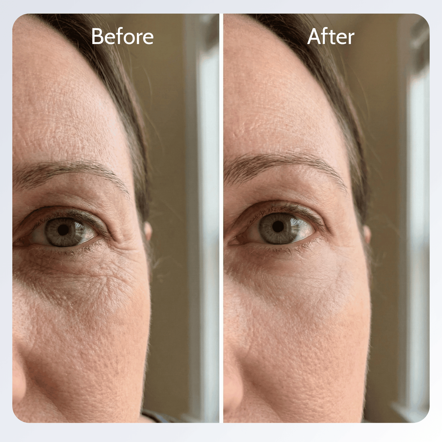 Volufiline Deep Collagen Cream in Serum