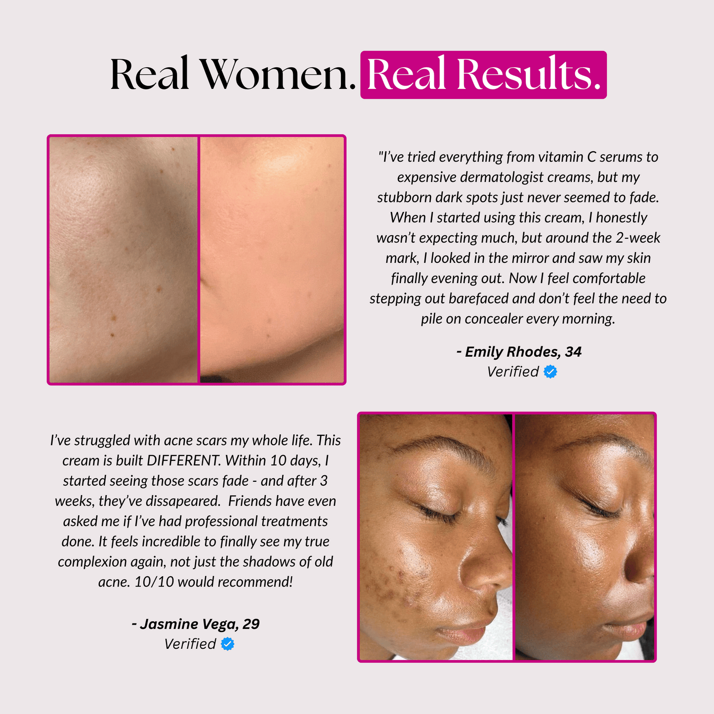 Arbutin 7% + TXA 4% Brightening Cream