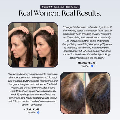 Deepreach™ Hair Restoration System