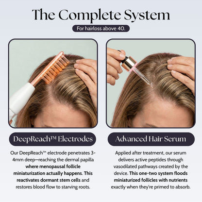 Deepreach™ Hair Restoration System